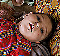 Шокирующие данные: НАТО виновна в появлении больных детей в Ираке