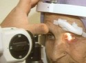 100 ветеранам заменят глазные хрусталики