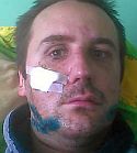 На журналиста российского агентства в Запорожье напали с заточкой